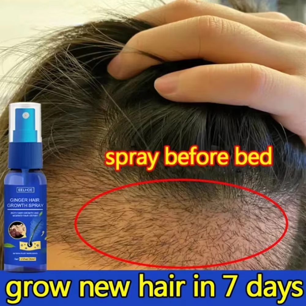 Hair Care For Hair Loss - Ginger Hair Growth spray Anti Hair