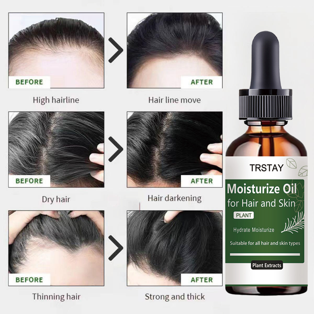 TRSTAY Rosemary Essential Oil  - Rosemary Hair Oil recensie en prijs