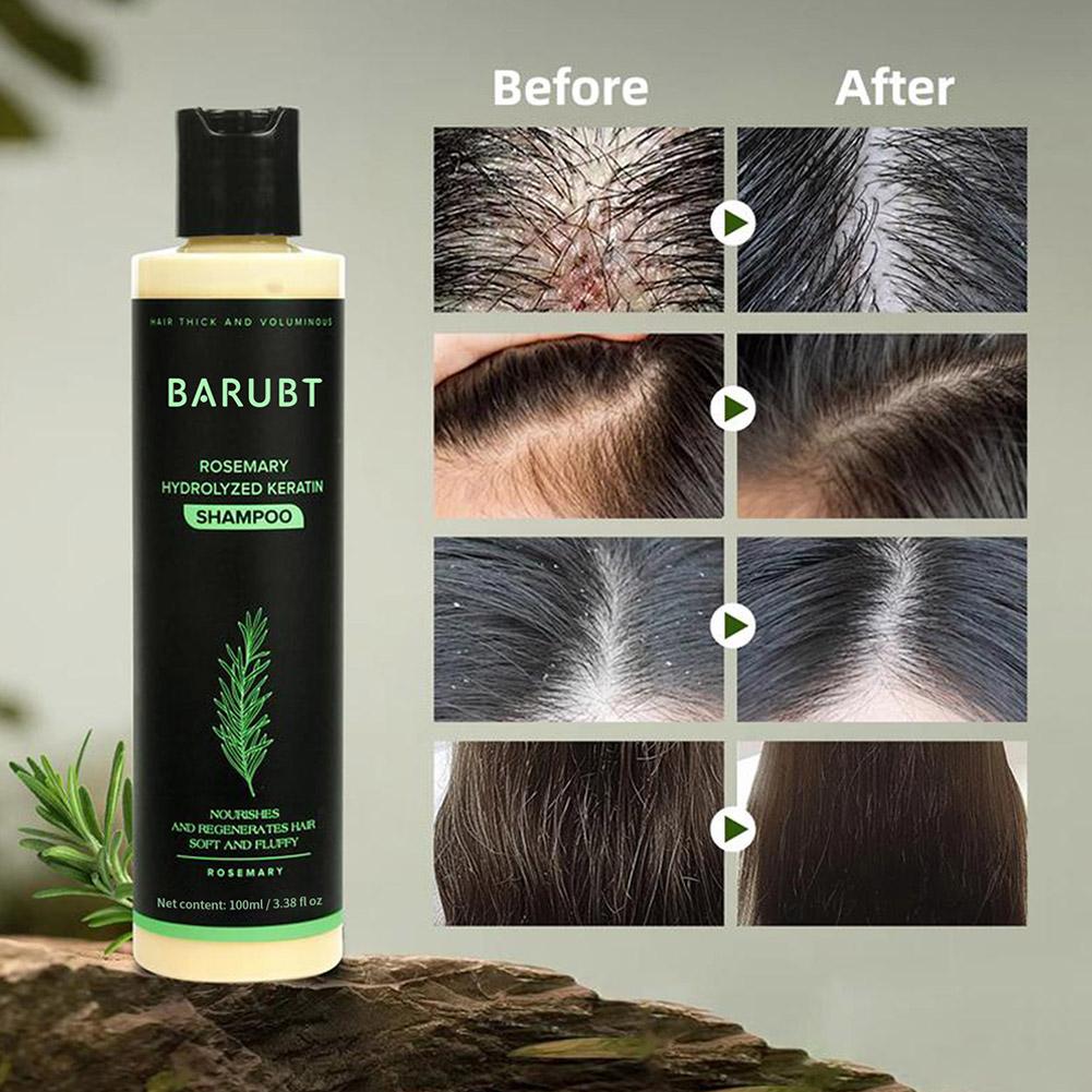 Rosemary Shampoo Hair Growth D - Rosemary Hair Oil recensie en prijs