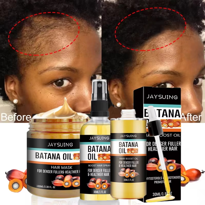 Batana Oil Thick Hair Serum Sp - Hair Care Essence Oil Spray recensie en prijs