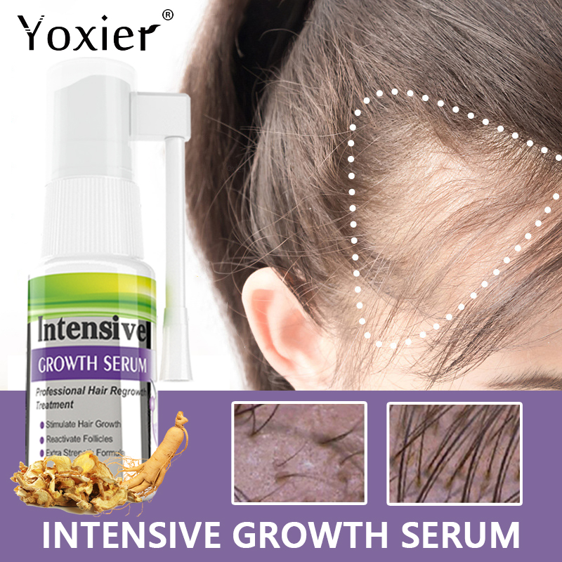 Intensive Growth Serum Prevent - Hair Care For Hair Loss recensie en prijs