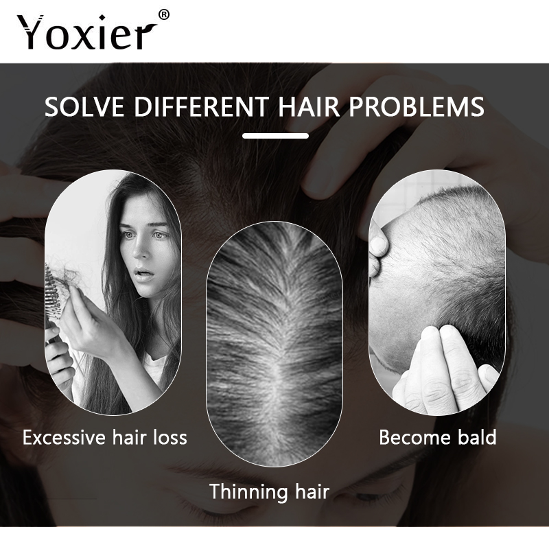 Intensive Growth Serum Prevent - Hair Care For Hair Loss recensie en prijs