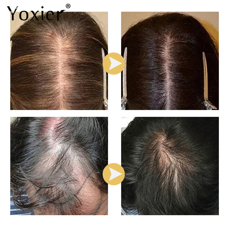 Intensive Growth Serum Prevent - Hair Care For Hair Loss recensie en prijs