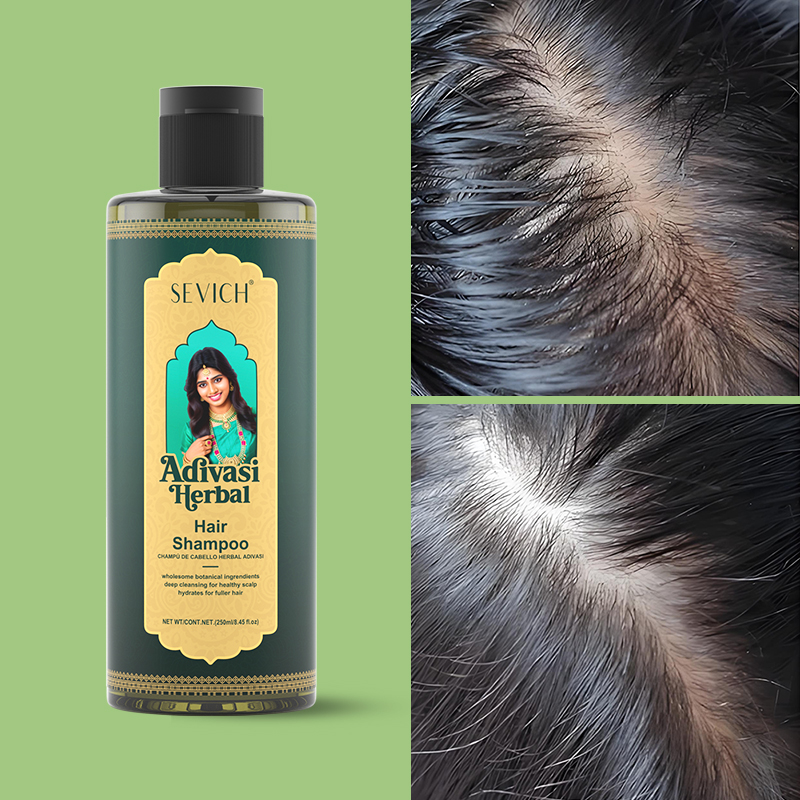 SEVICH Herbal Hair Growth Oil  - Hair Care India recensie en prijs
