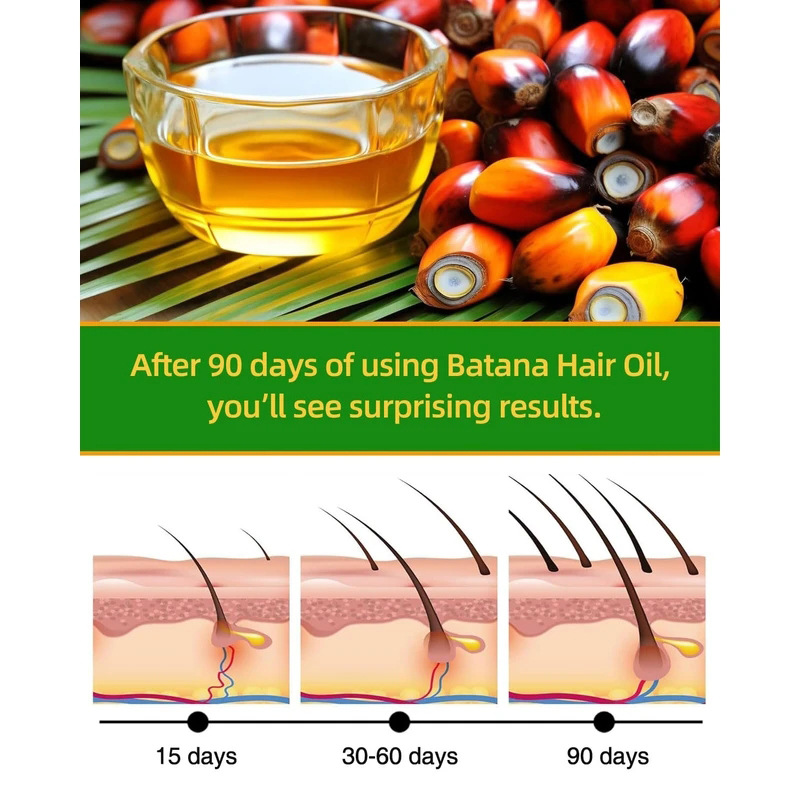 Batana Rosemary Hair Care Esse - Rosemary Hair Oil recensie en prijs