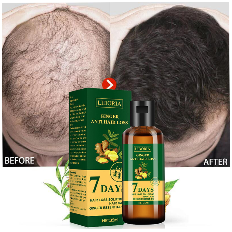 Ginger Hair Growth Essential O - Hair Care Essence Oil Spray recensie en prijs