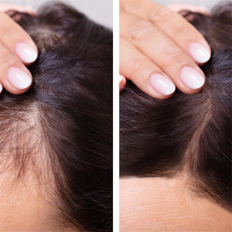 Ginger Hair Growth Essential O - Hair Care Essence Oil Spray recensie en prijs