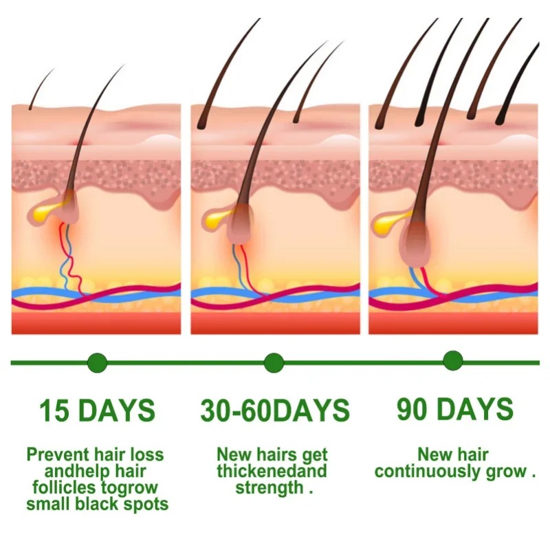Hair Growth Serum Fast Growing - Hair Care Essence Oil Spray recensie en prijs