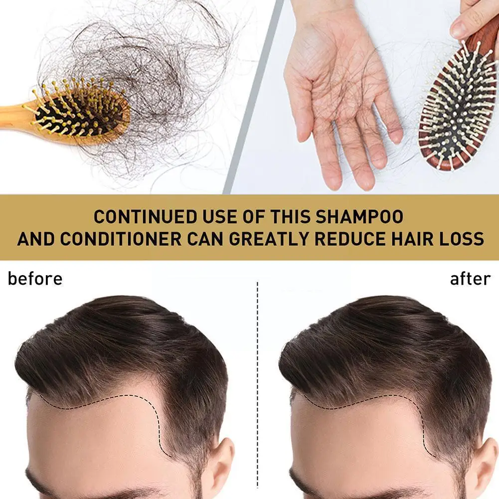 Ginger Essence Shampoo Anti Ha - Hair Care Dandruff recensie en prijs