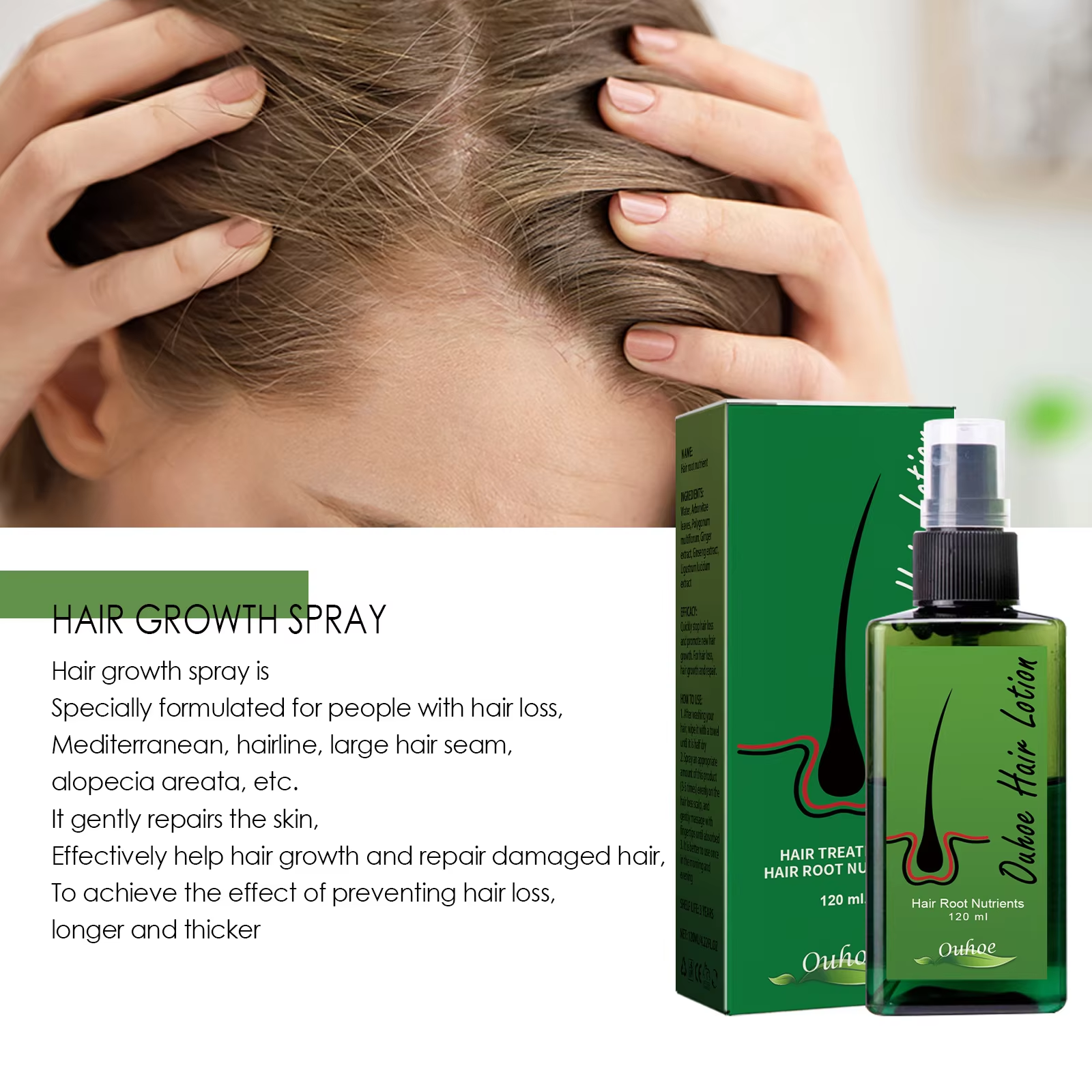 Hair Growth Spray Anti Hair Lo - Hair Care For Hair Loss recensie en prijs