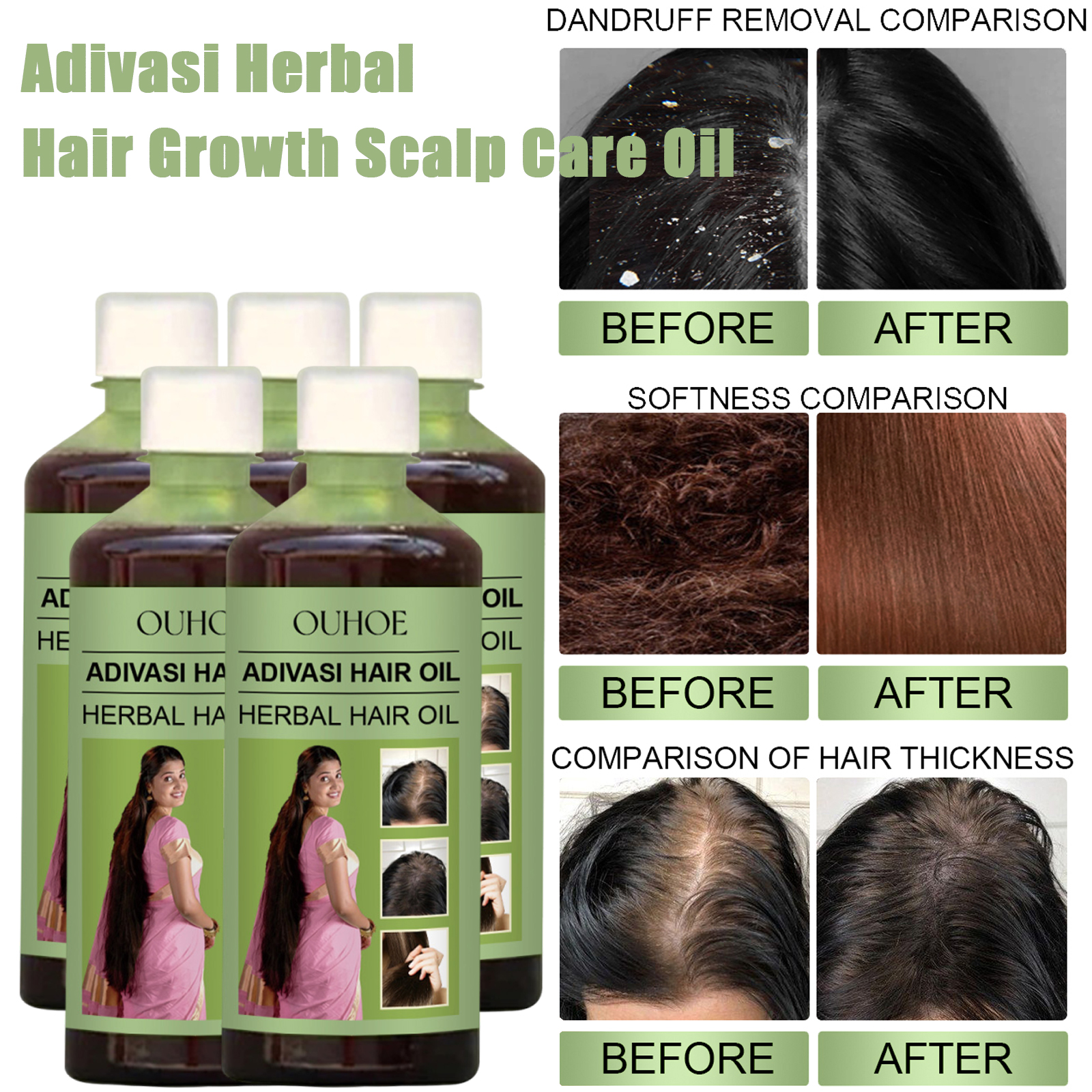 100ml Hair Growth Oil India Ad - Hair Care India recensie en prijs