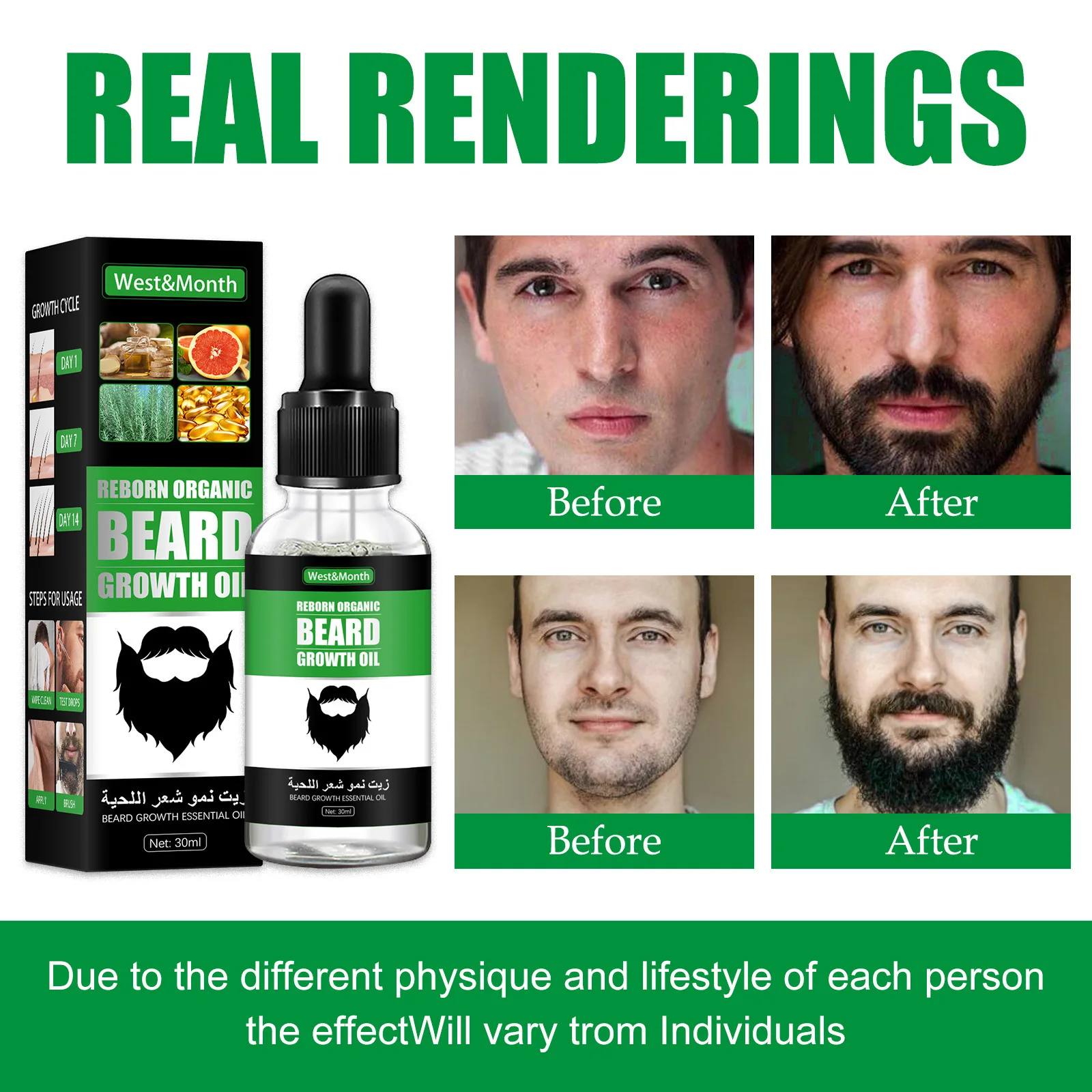 Men Beard Growth Roller Set Be - Hair Care Essence Oil Spray recensie en prijs