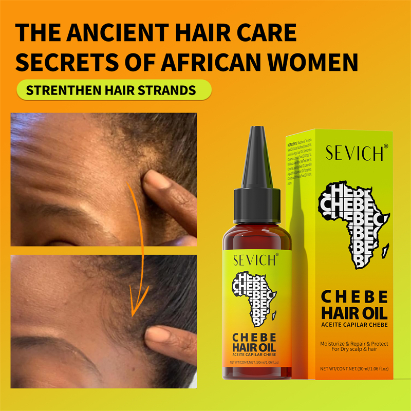 Chebe Fast Hair Growth Oil Afr - Hair Care Essence Oil Spray recensie en prijs