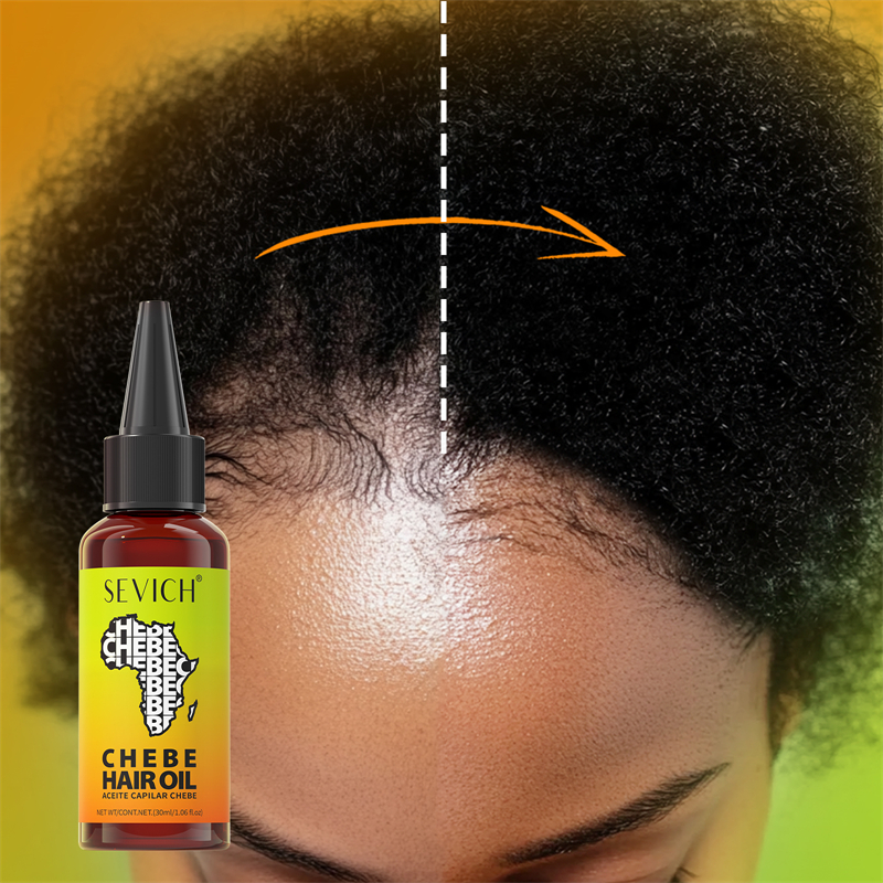 Chebe Fast Hair Growth Oil Afr - Hair Care Essence Oil Spray recensie en prijs