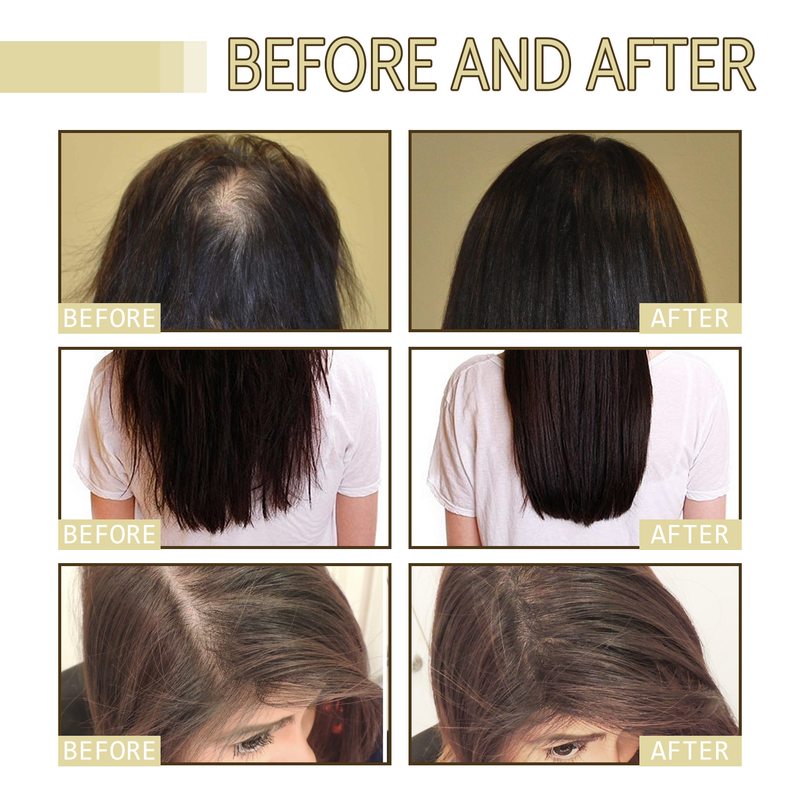 Rosemary Hair Growth Oil 60ml  - Hair Care For Hair Loss recensie en prijs