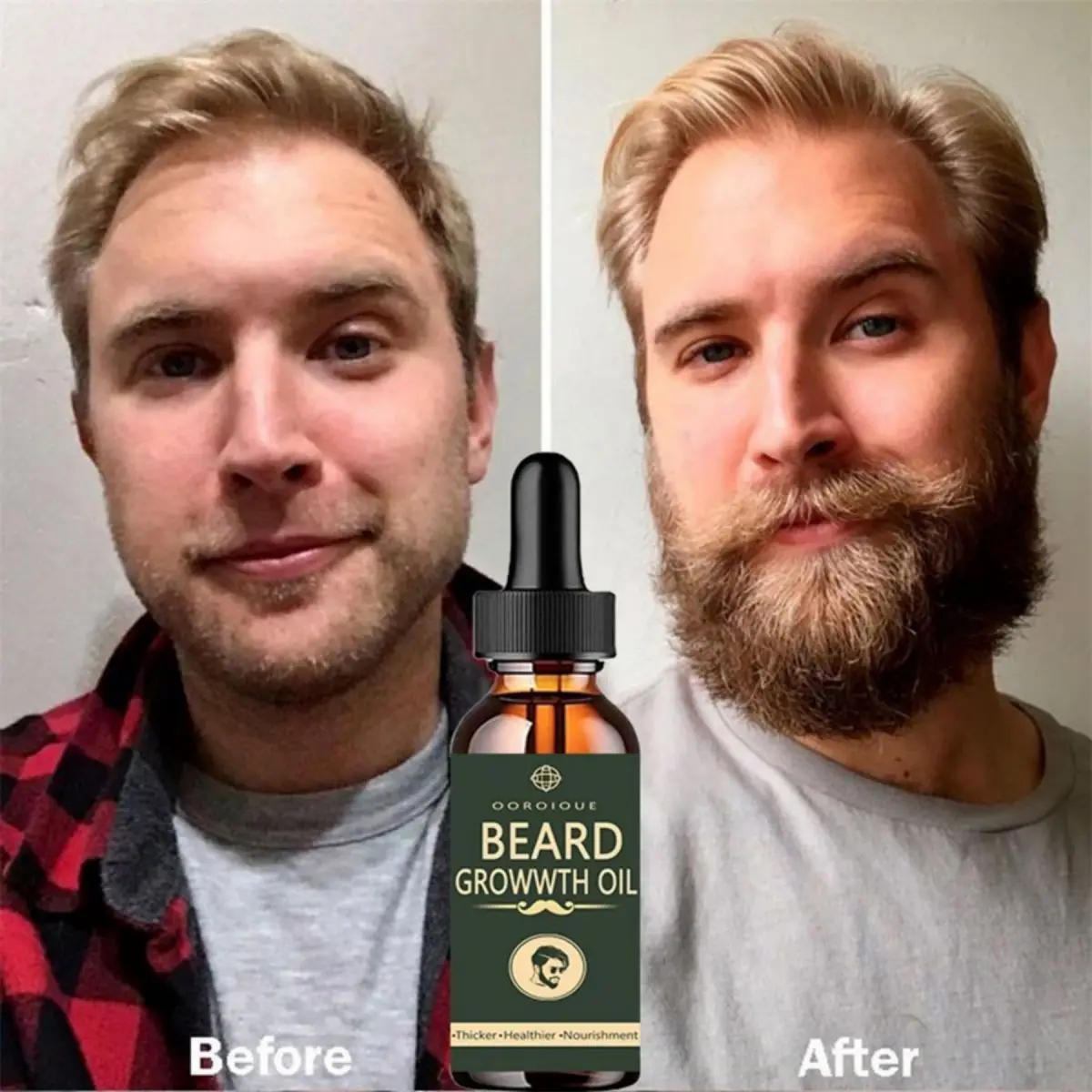 Fast Beard Growth Oil Beard Oi - Hair Care Essence Oil Spray recensie en prijs