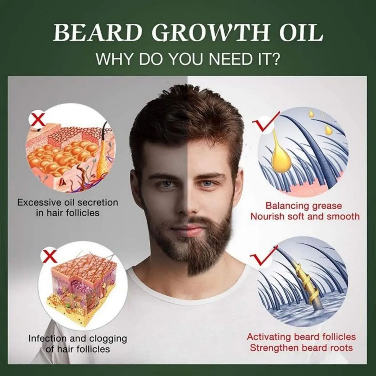 Fast Beard Growth Oil Beard Oi - Hair Care Essence Oil Spray recensie en prijs
