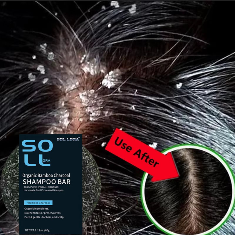 Fast Anti Dandruff Hair Treatm - Hair Care Dandruff recensie en prijs