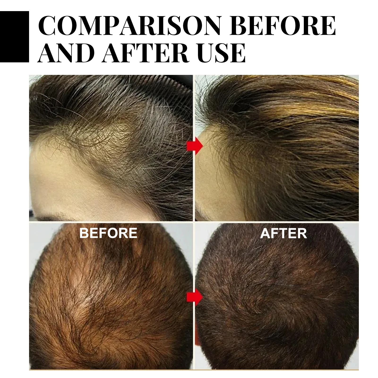 Ginger Hair Growth spray Anti  - Hair Care For Hair Loss recensie en prijs