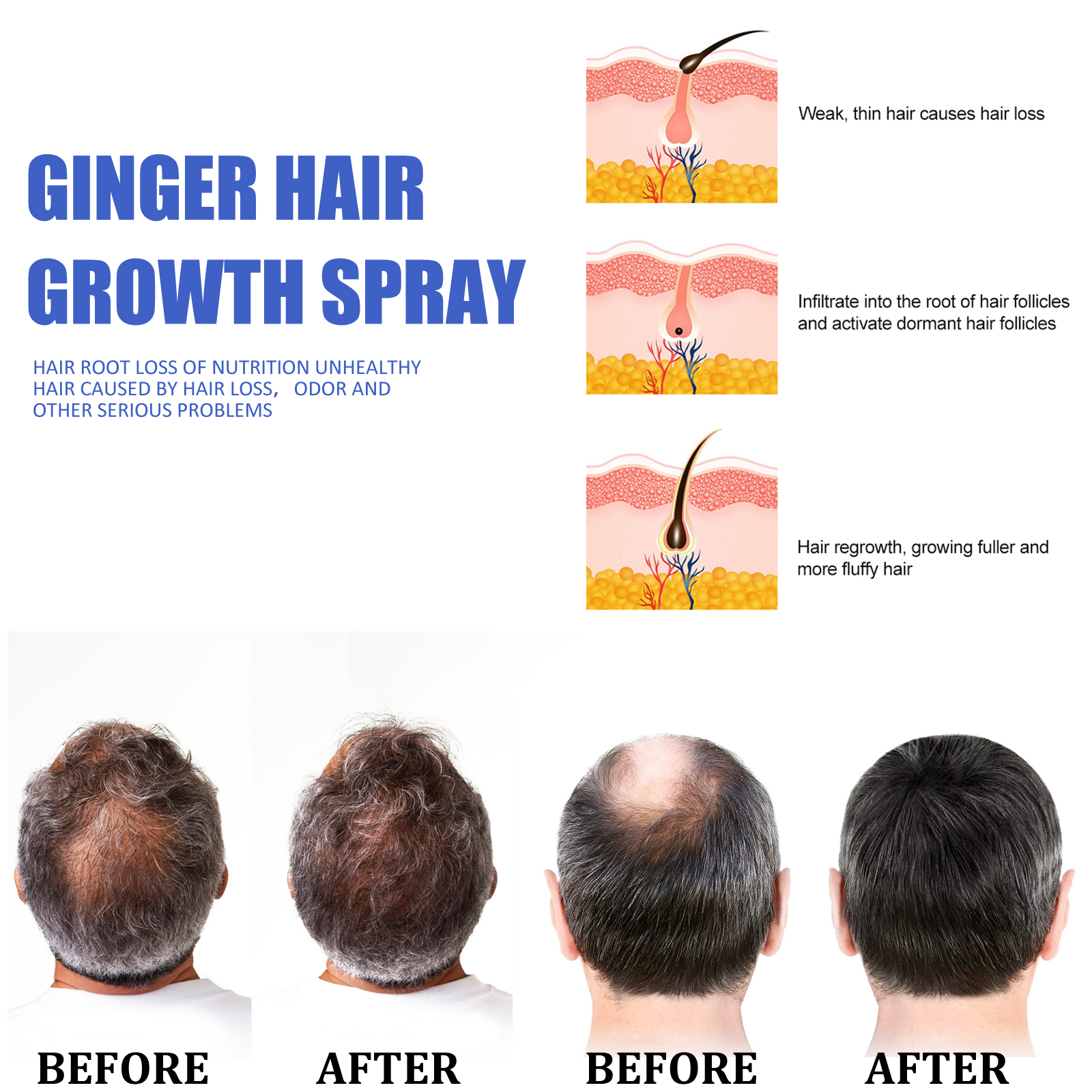 Ginger Hair Growth spray Anti  - Hair Care For Hair Loss recensie en prijs