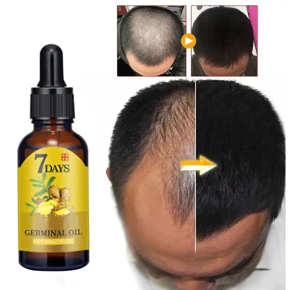 Hair Growth Ginger Fast Growin - Hair Care Essence Oil Spray recensie en prijs