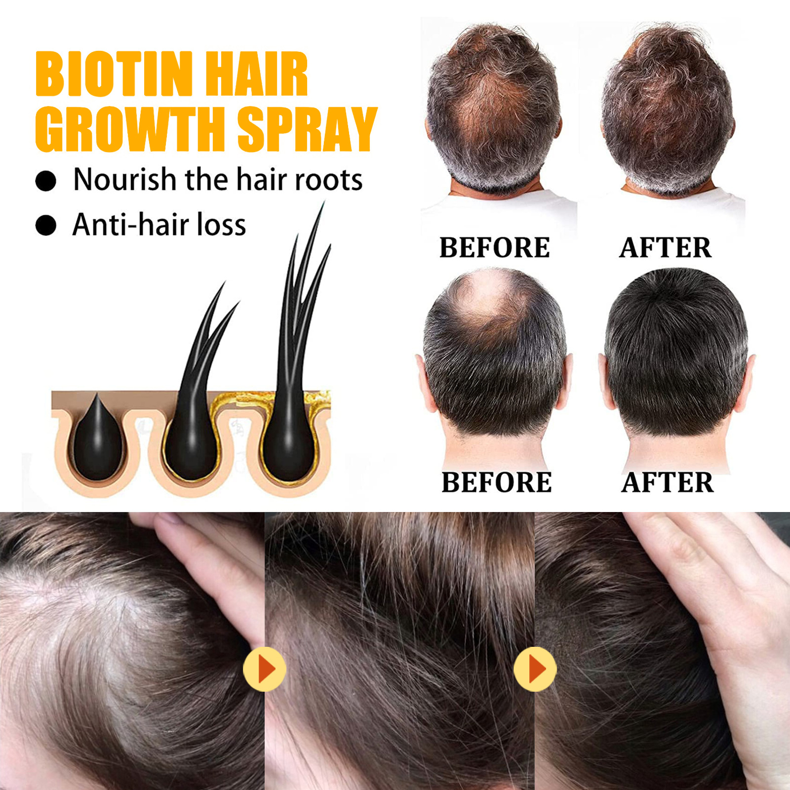 Biotin Hair Care Spray Nourish - Hair Care Essence Oil Spray recensie en prijs