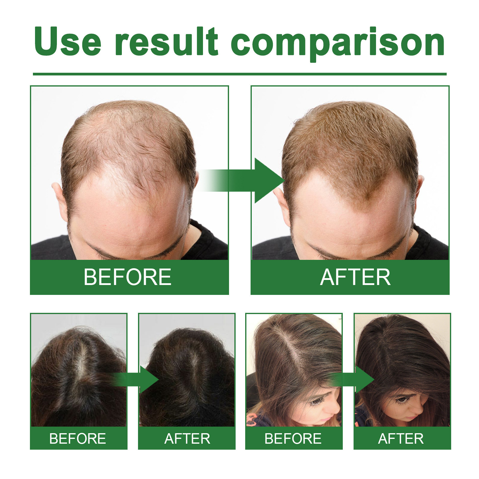 Rosemary Spray for Hair Nouris - Hair Care For Hair Loss recensie en prijs