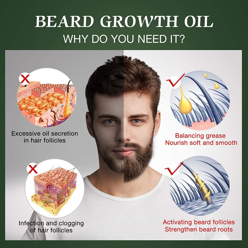 Fast Beard Growth Oil Beard Oi - Hair Care Essence Oil Spray recensie en prijs