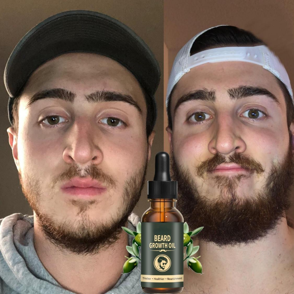 Fast Beard Growth Oil Beard Oi - Hair Care Essence Oil Spray recensie en prijs