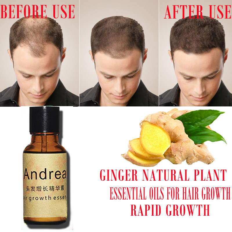 2/5/10Pcs Andrea Hair Growth S - Hair Care Essence Oil Spray recensie en prijs
