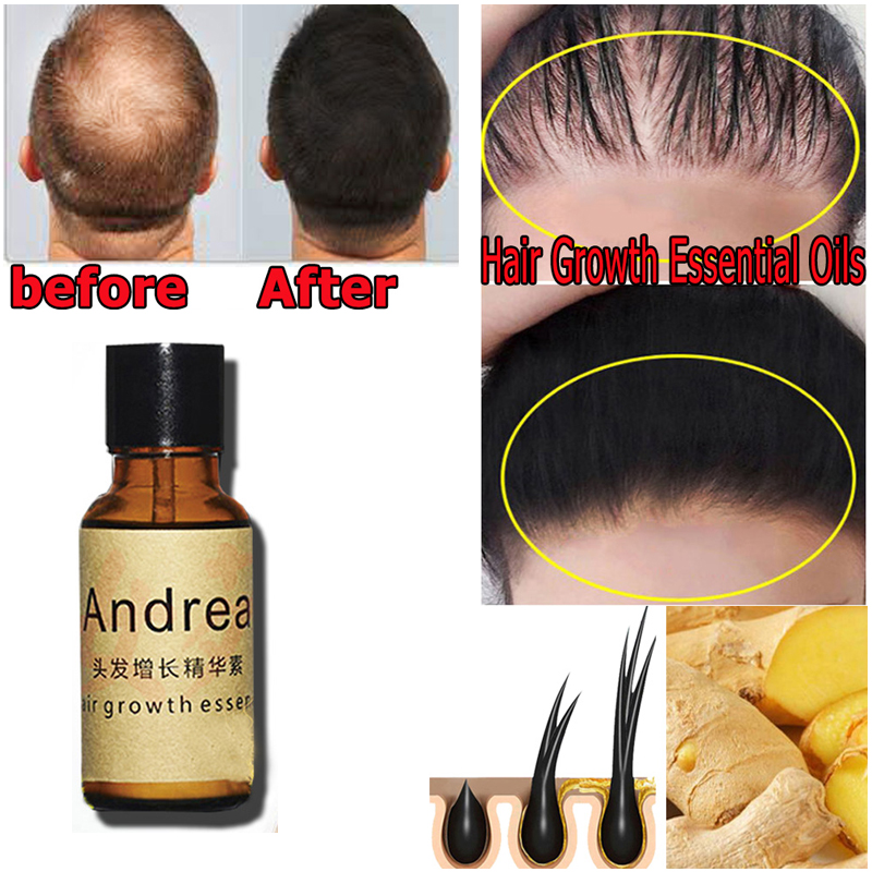 2/5/10Pcs Andrea Hair Growth S - Hair Care Essence Oil Spray recensie en prijs