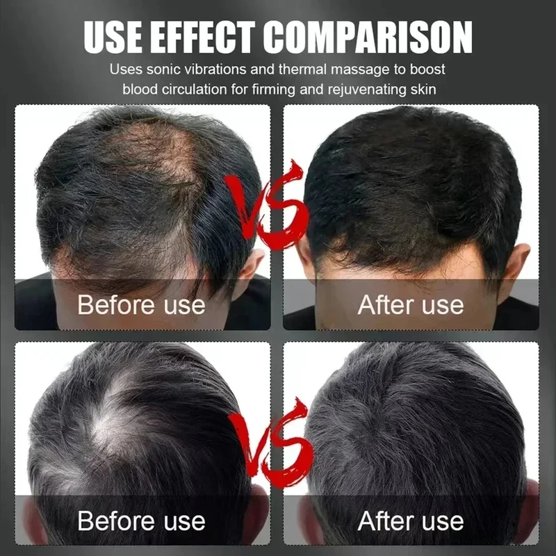 660nm 850nm Red Light Infrared - Hair Care For Hair Loss recensie en prijs